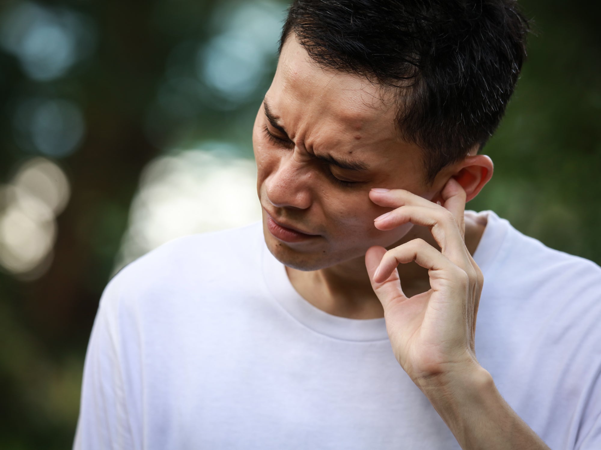 How To Apply Cream To Eczema In The Ears Balmonds