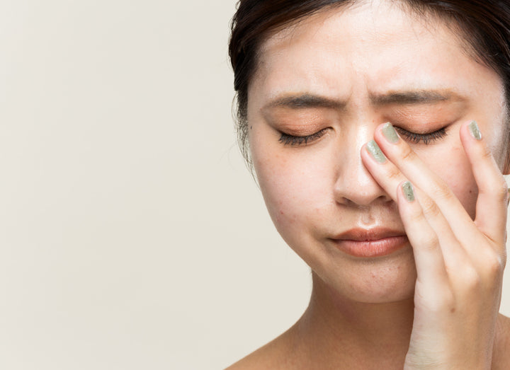 Will Periocular Dermatitis Heal On Its Own?