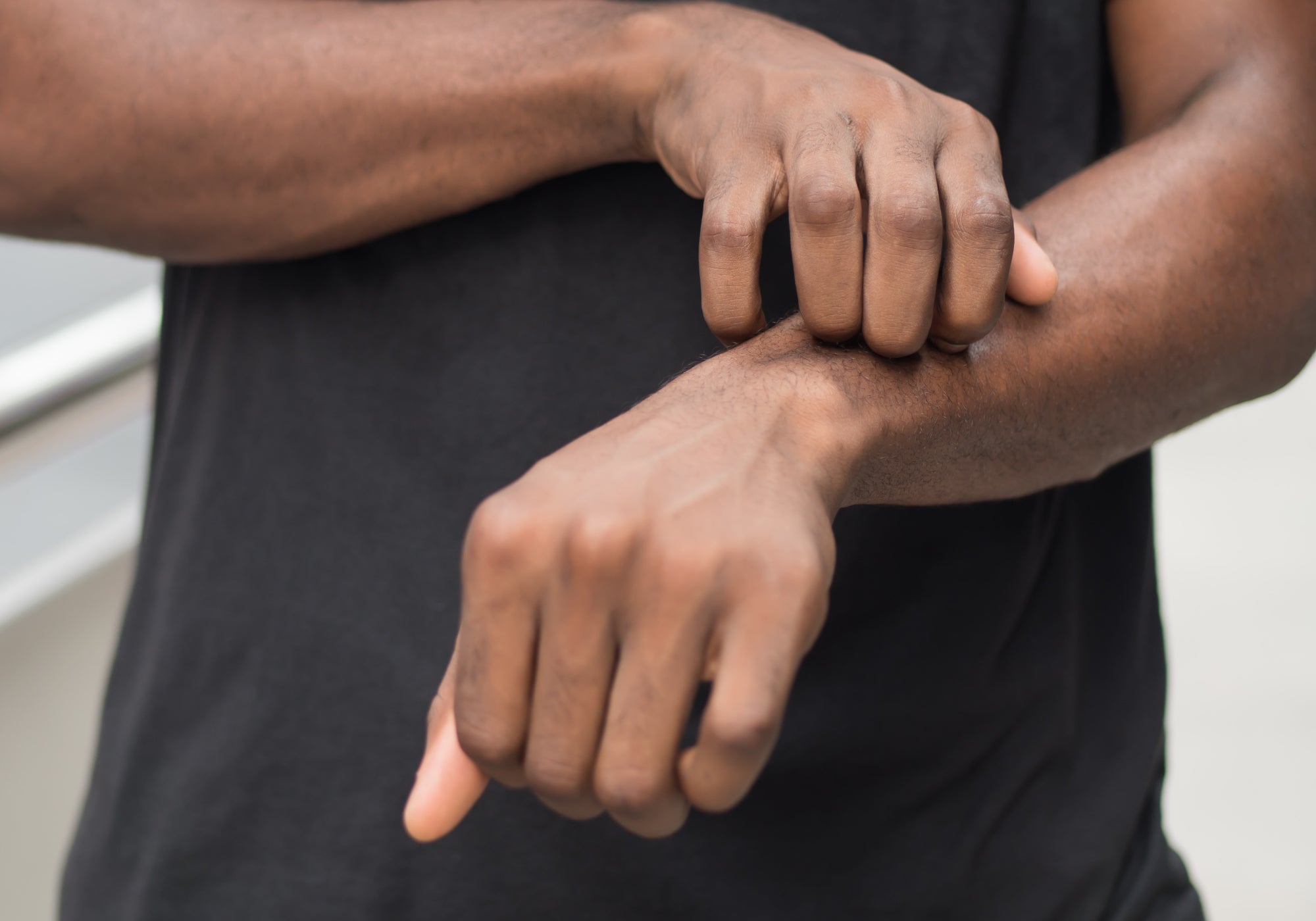 Top Tips For Stopping Diabetic Itchy Skin