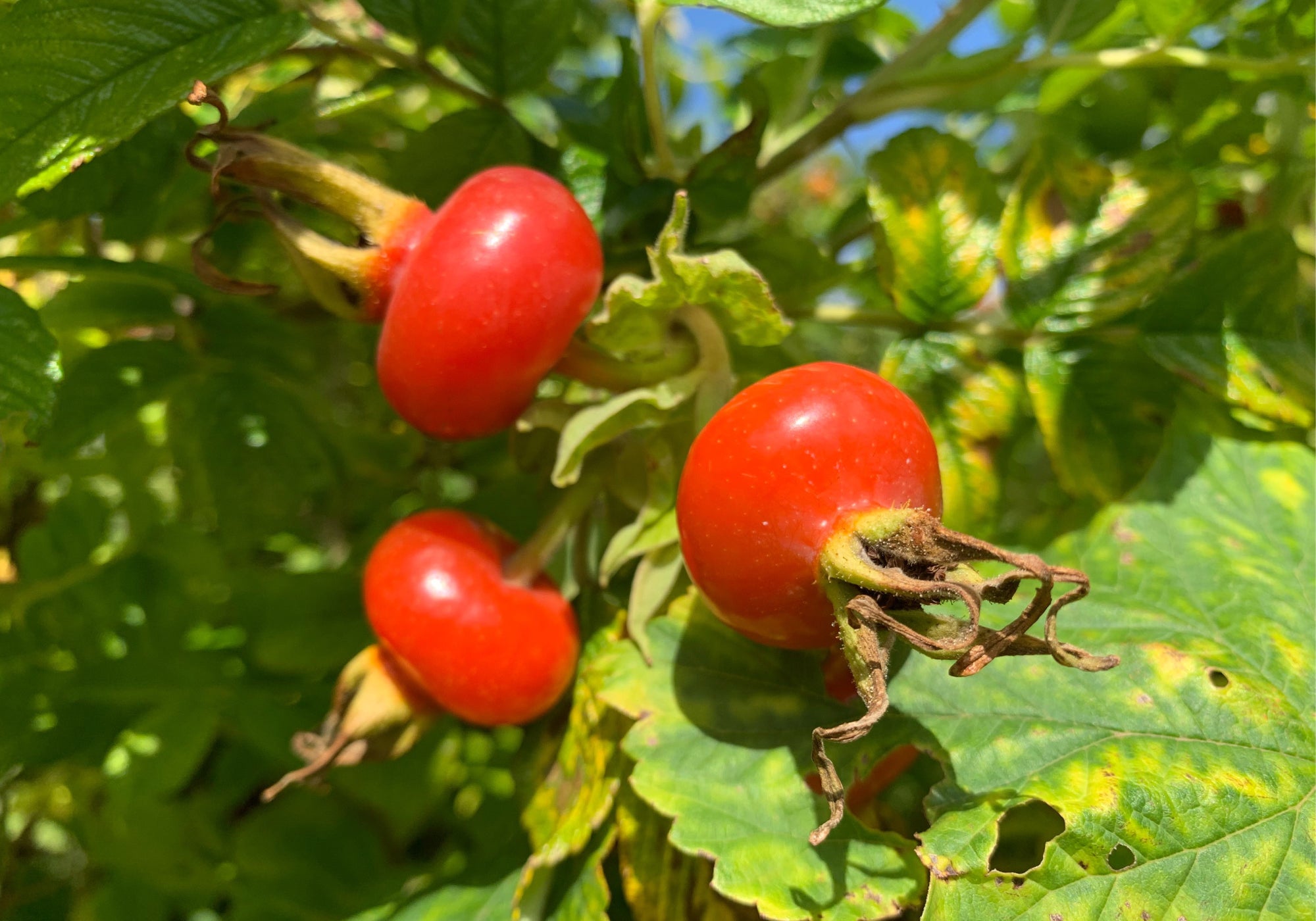 Is Rosehip Oil Good For Perioral Dermatitis?