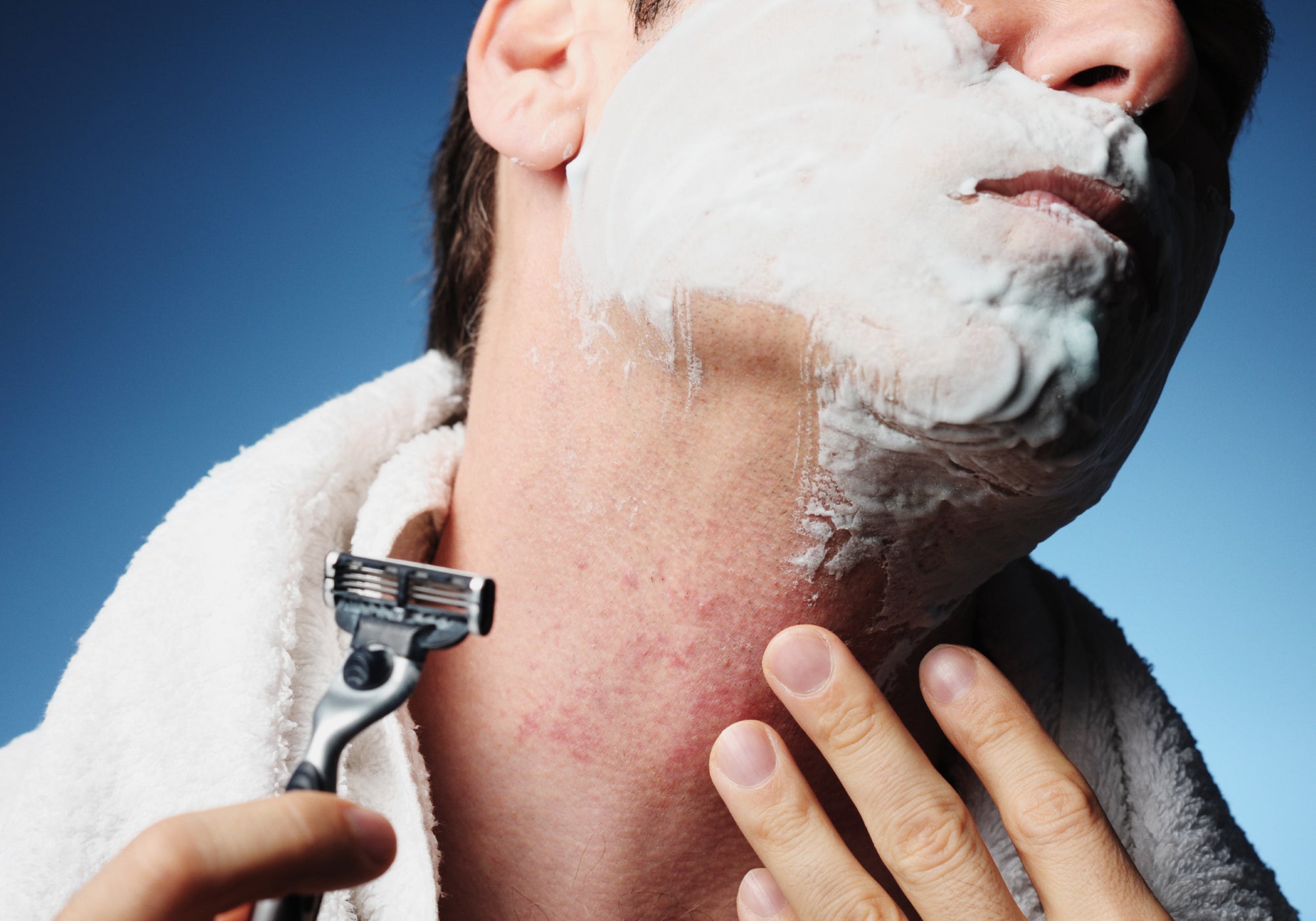 What Causes Scalp Folliculitis?