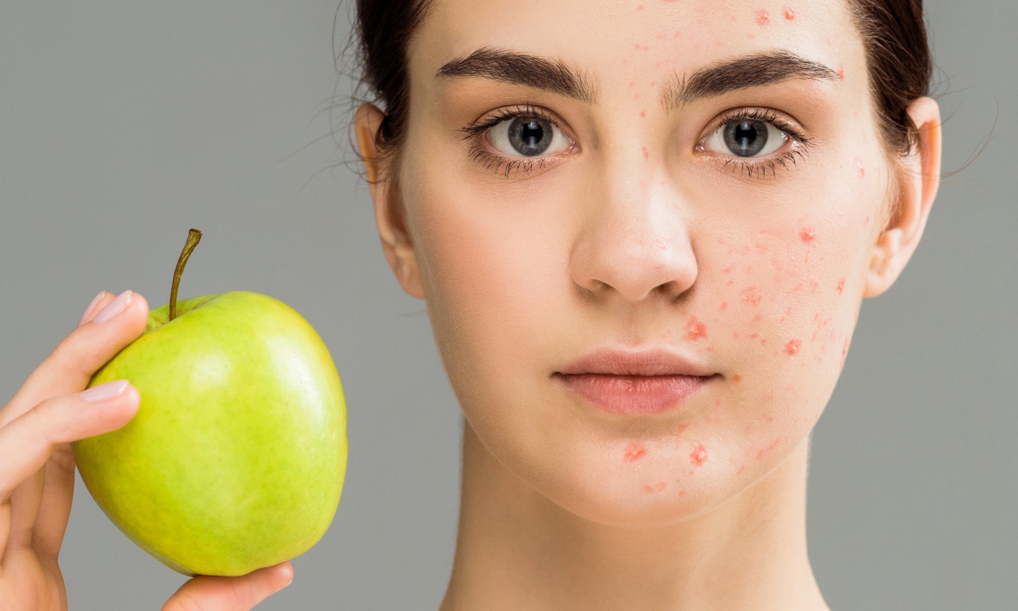 How Long Does It Take For Diet To Affect Skin?