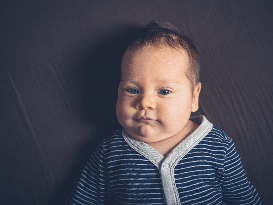 What's The Best Natural Shampoo For Seborrheic Dermatitis? Balmonds