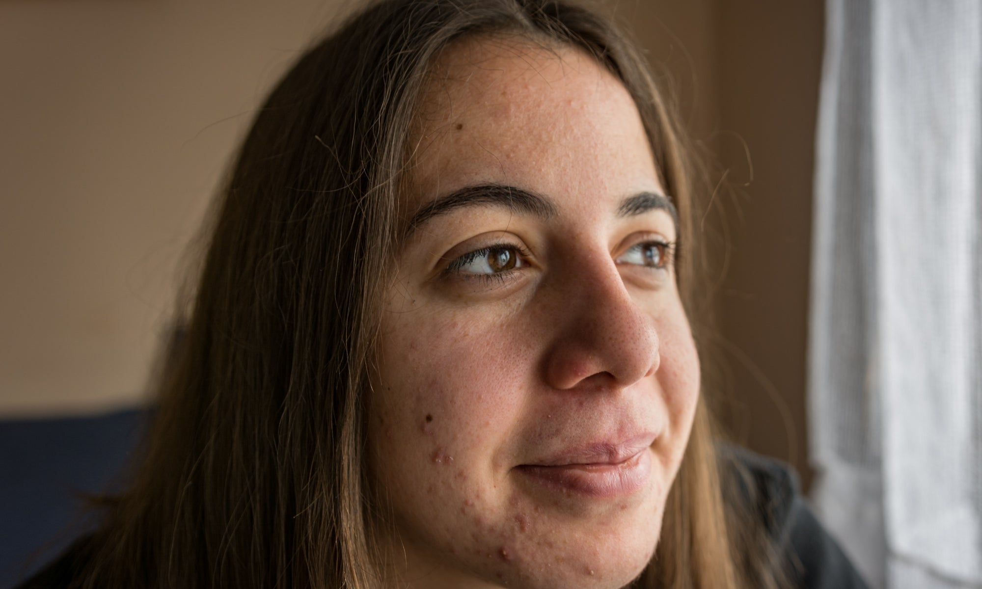 Chemotherapy – Balmonds