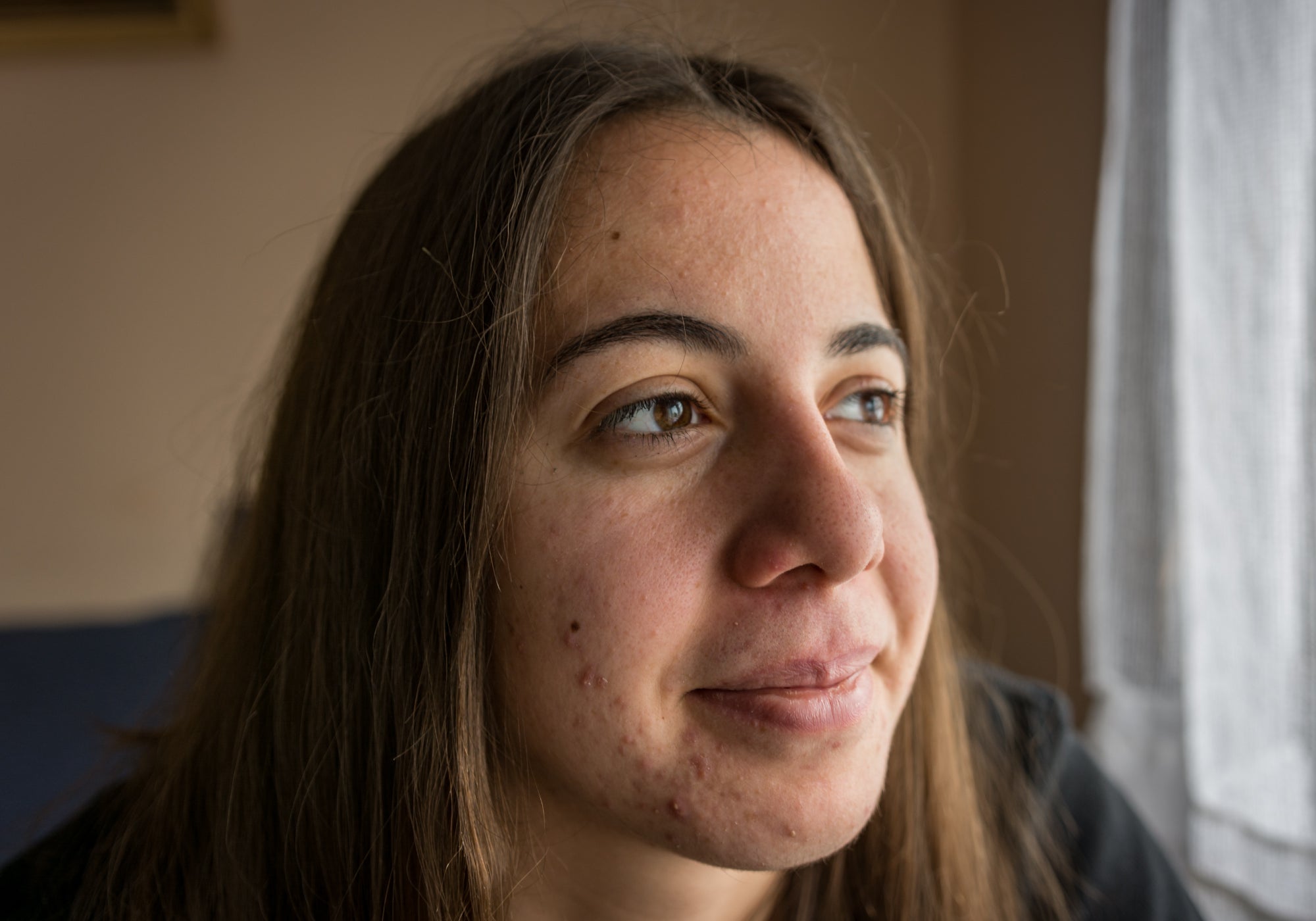 What Do Chemo Rashes Look Like?