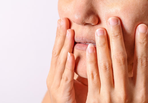 damaged skin on face