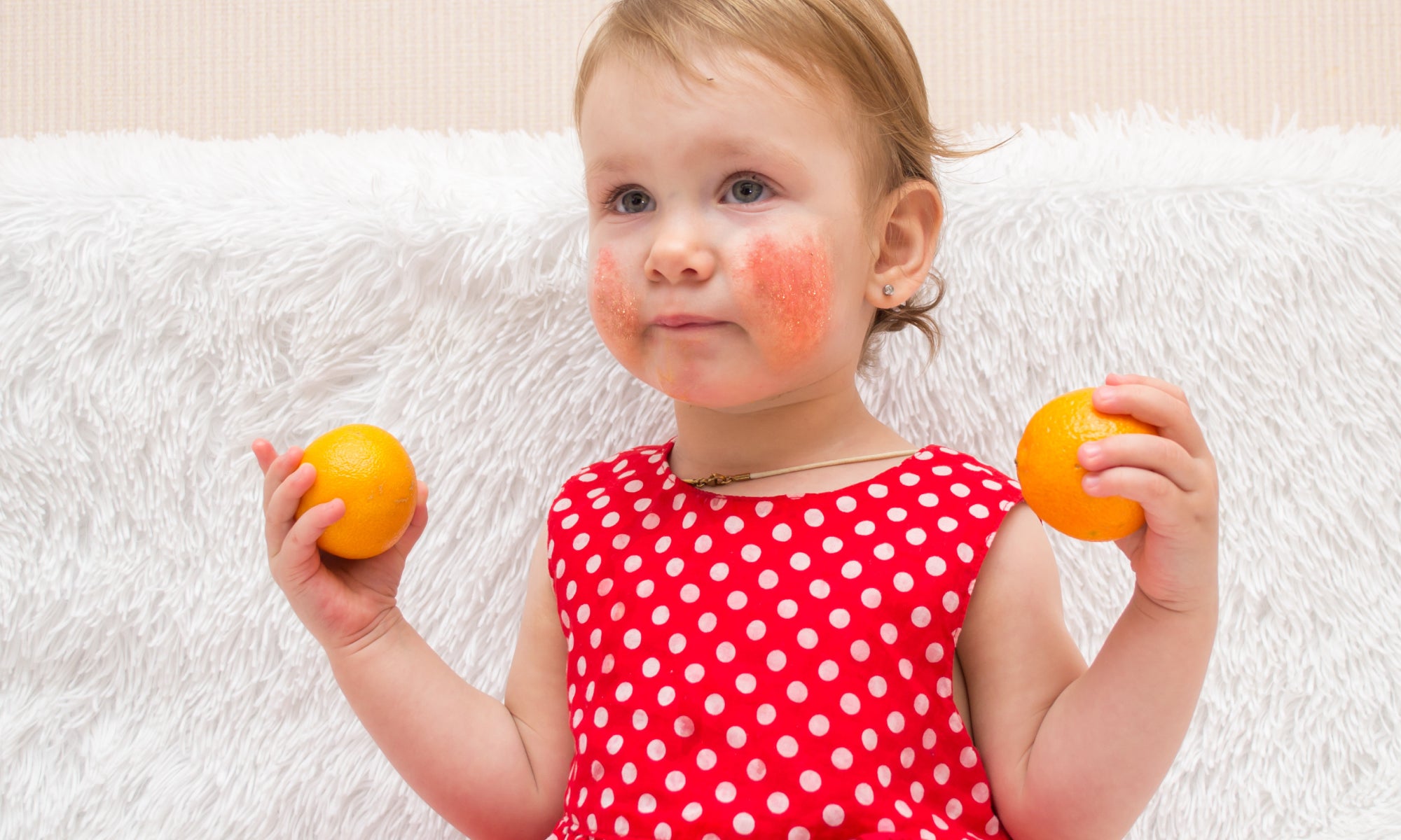 Baby with eczema holding satsumas