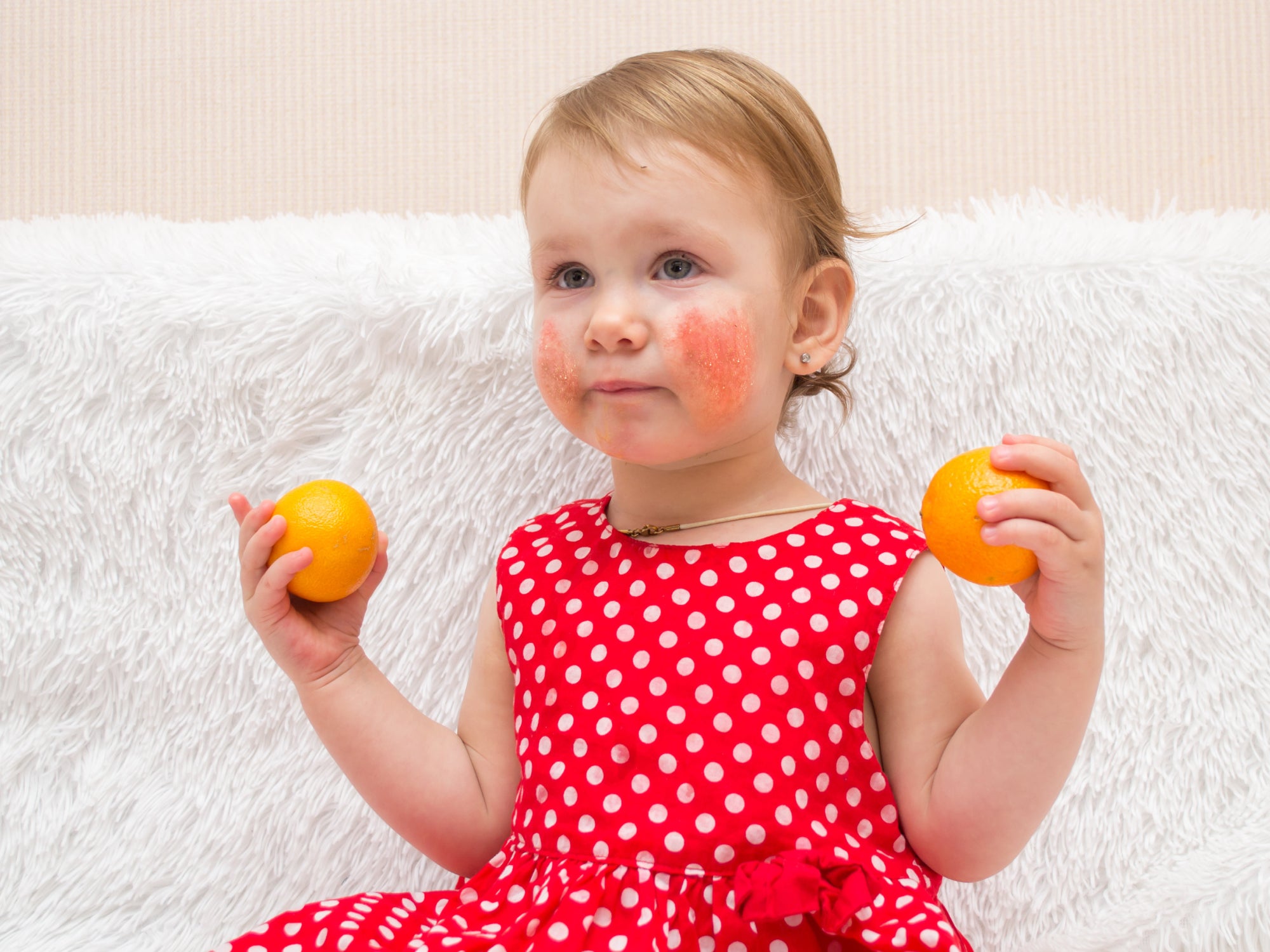 Baby with eczema holding satsumas