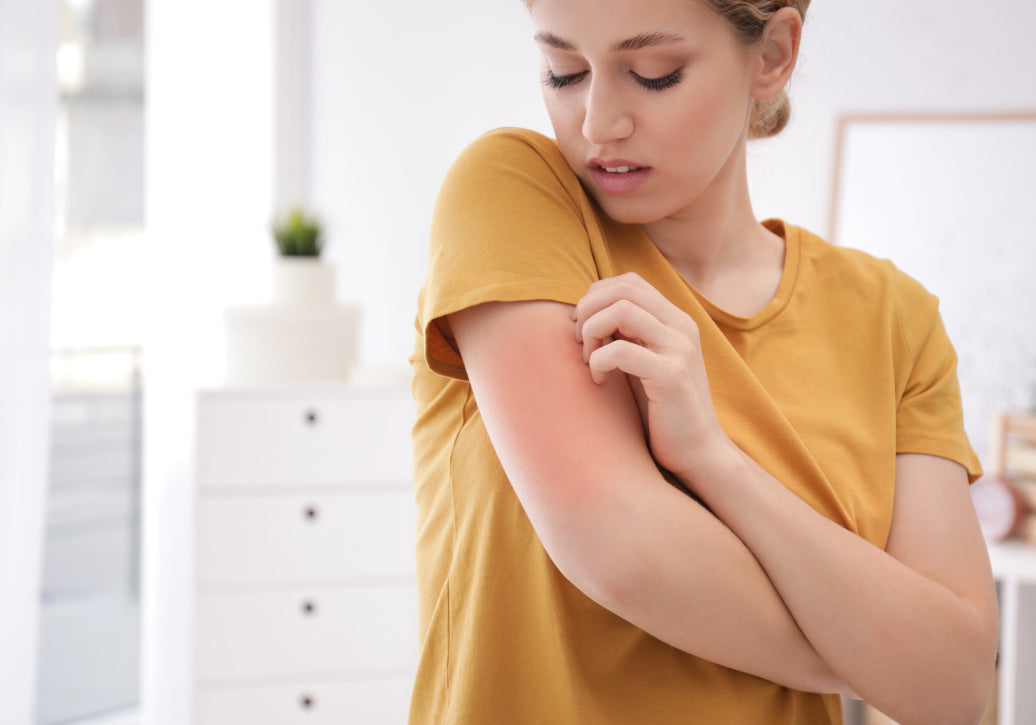 Does Polymorphic Light Eruption Ever Go Away?