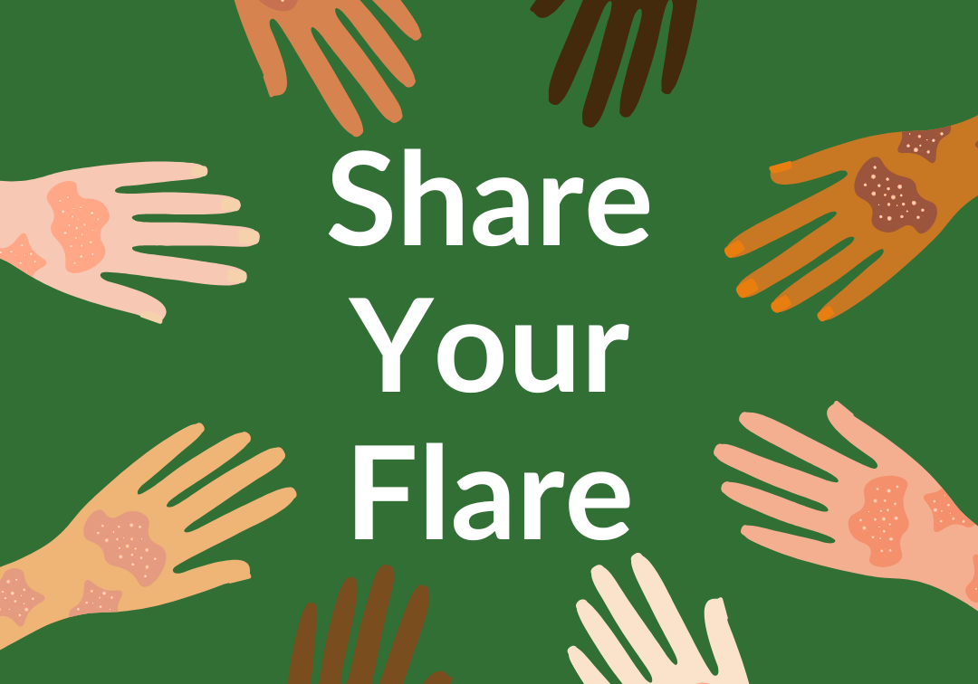 #ShareYourFlare Campaign