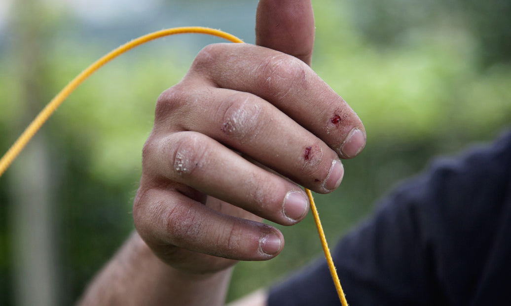 A climber holding some thin rope, showing grazes and marks on hands