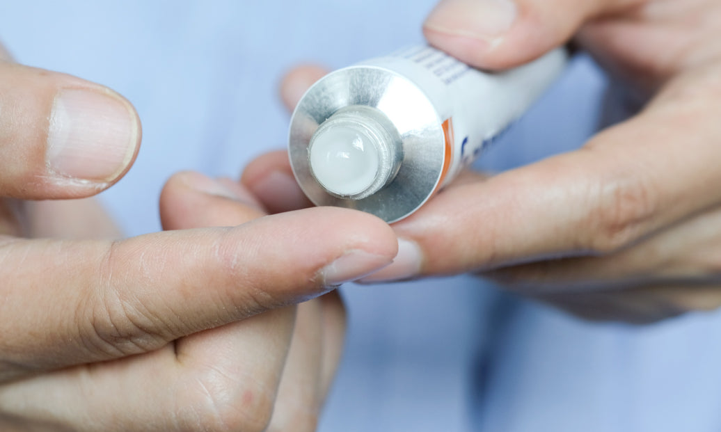 Squeezing steroid cream out of a tube onto a finger before applying