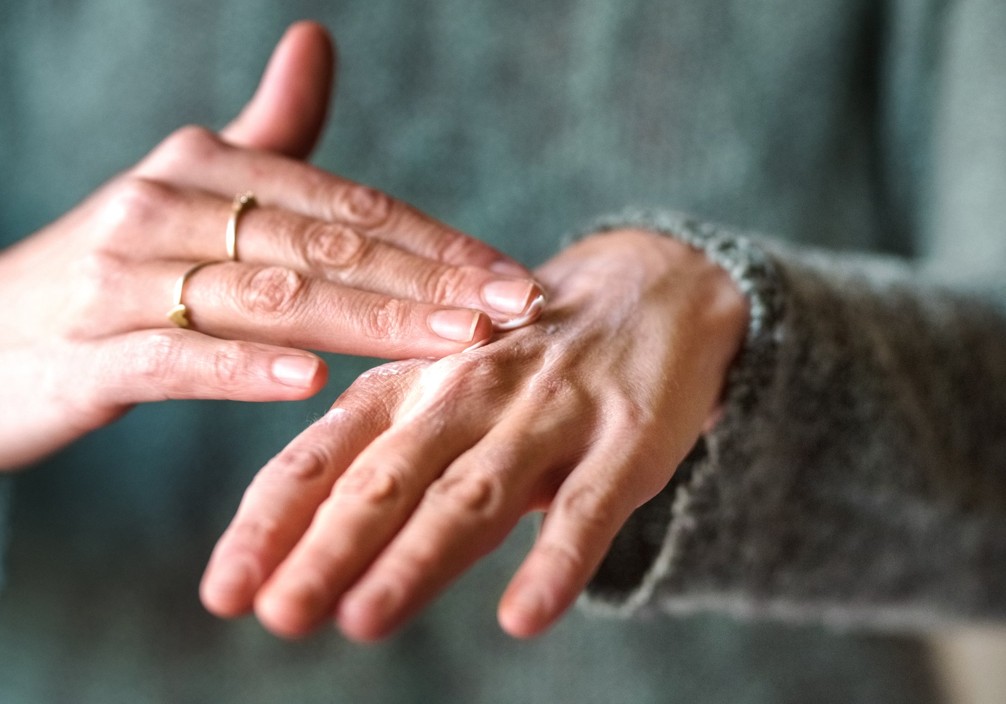 What’s The Best Natural Moisturiser For Chemo Rash?