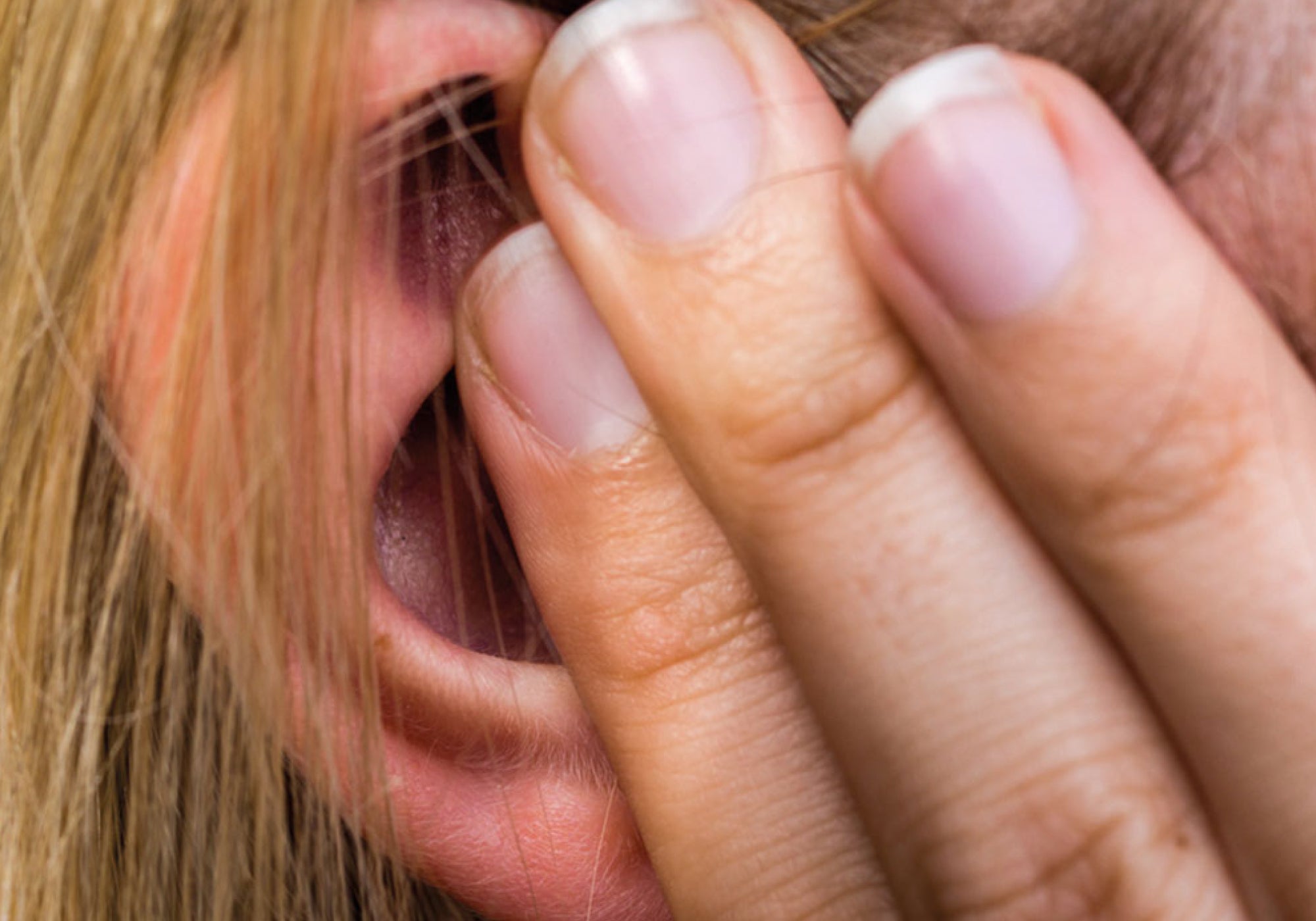 How To Treat Ear Psoriasis