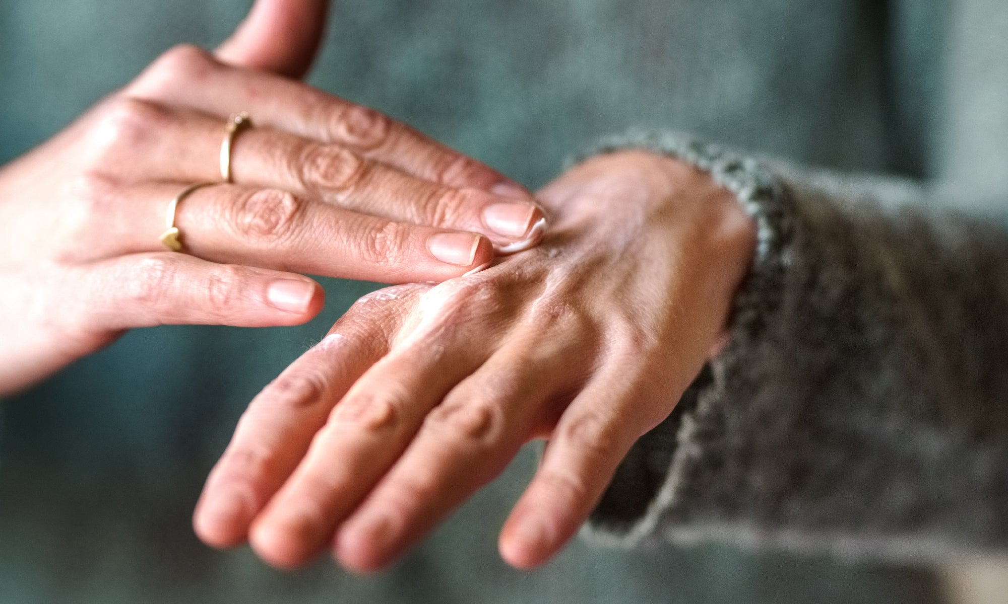 5 Top Tips To Manage Chronically Dry, Cracked Hands