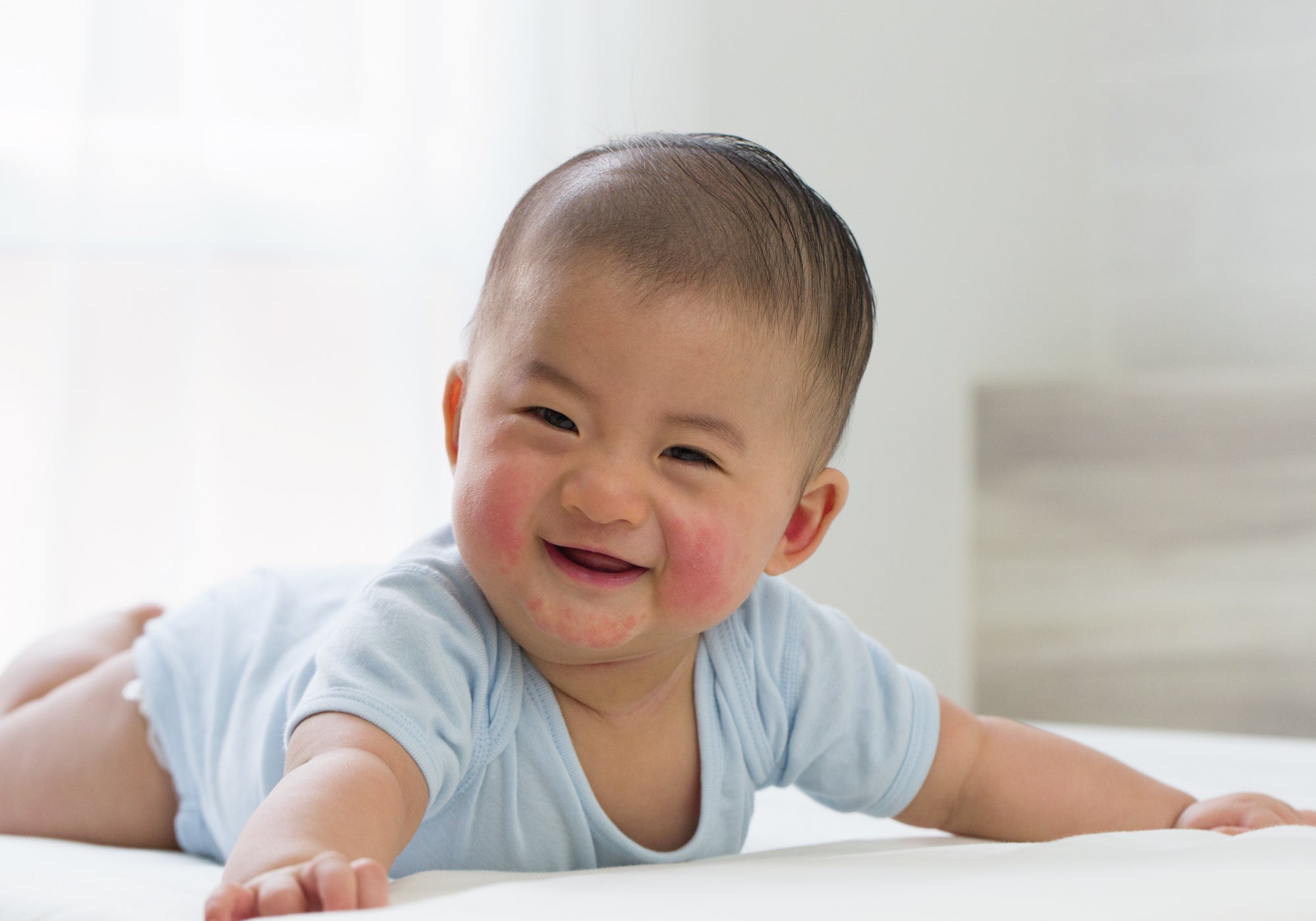 How To Wet Wrap A Baby With Eczema