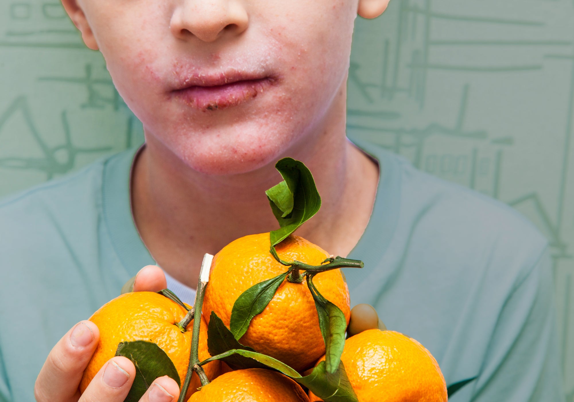 6 Signs You Might Have A Food Intolerance
