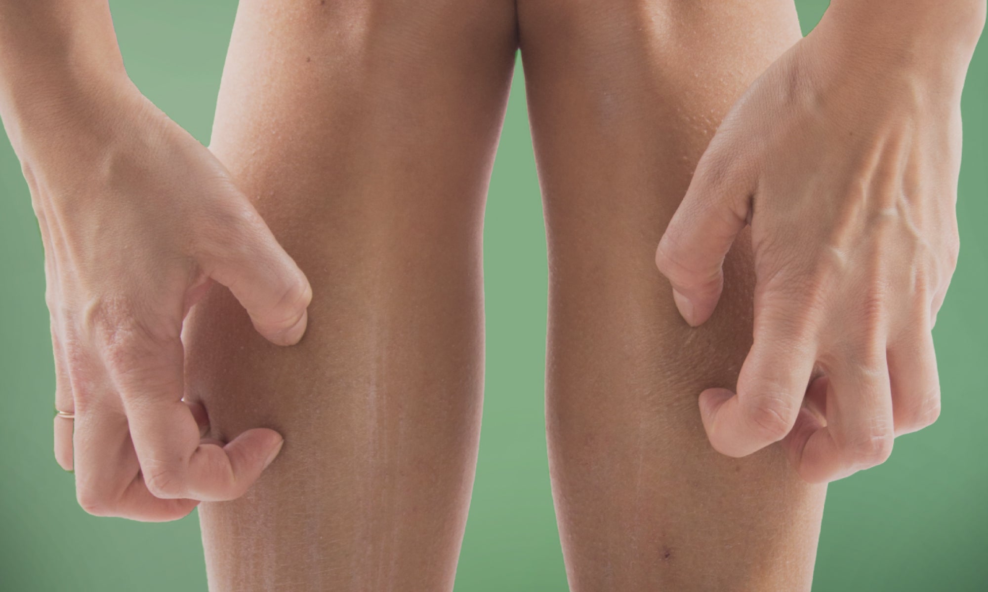 6 Common Causes Of Itchy Lower Legs