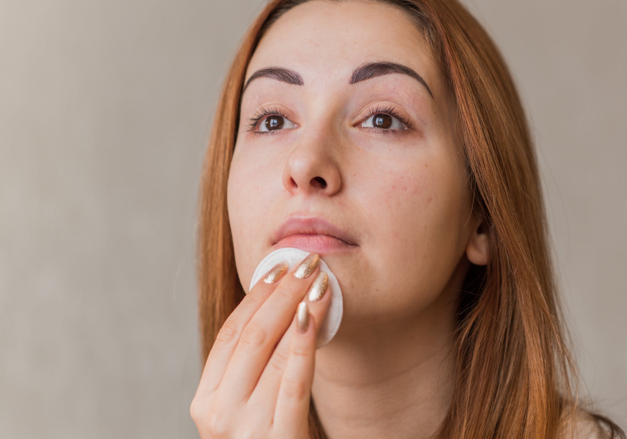 What Is Seborrhoea And How Do You Do Treat It?