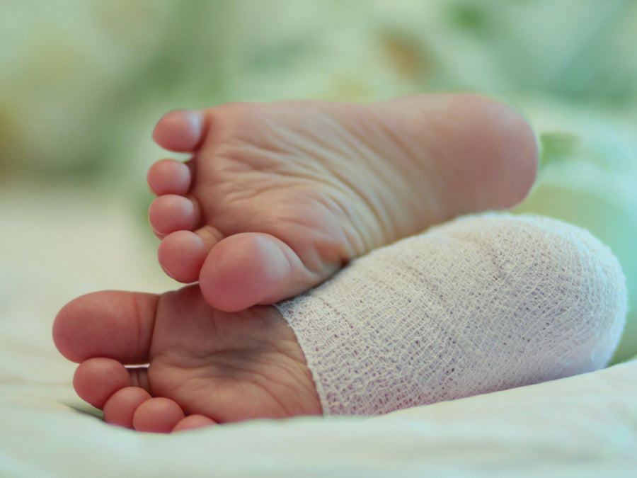 How To Wet Wrap Foot Eczema